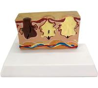 HUIBBGO Modelo de Estructura de la Piel a Nivel de Tejido Modelo de sección Transversal de la Piel Modelo de Piel patológica - Réplica de anatomía del Cuerpo Humano de Piel común Modelo de