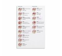 Human Skin Anatomy and Lesions Poster Dermatology Chart for Education and Wall Art(Framed,12x18inch(30x45cm))