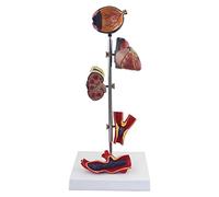 Humana Modelo Trombosis Cardiovascular Hipertensión Daño A Los Órganos Humanos Cerebro Cardiovascular