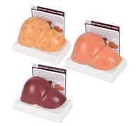 HUOYALU Modelo comparativo de hígado de Silicona, Modelo de anatomía del hígado Humano de tamaño Natural, para enseñanza médica y educación Sanitaria