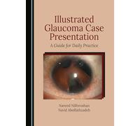 Illustrated Glaucoma Case Presentation: A Guide for Daily Practice