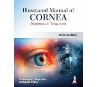 Illustrated Manual of Cornea: Diagnosis & Treatment