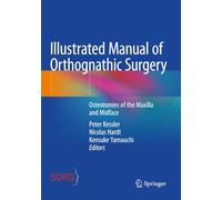 Illustrated Manual of Orthognathic Surgery: Osteotomies of the Maxilla and Midface