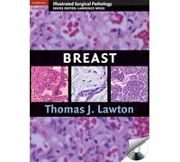 Illustrated Surgical Pathology of the Breast (Cambridge Illustrated Surgical Pathology)