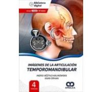 Imagenes De La Articulacion Temporomandibular