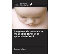 Imágenes de resonancia magnética (RM) en la epilepsia infantil