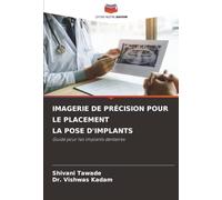 IMAGERIE DE PRÉCISION POUR LE PLACEMENT LA POSE D'IMPLANTS: Guide pour les implants dentaires