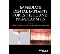 Immediate Dental Implants for Esthetic and Premolar Sites
