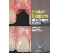 Implant Dentistry at a Glance (At a Glance (Dentistry))