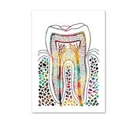 Implante de dientes abstracto herramientas belleza Dental cuadro sobre lienzo for pared carteles nórdicos e impresiones cuadros for decoración Hospital(E,13X18 cm Unframed)