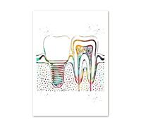Implante de dientes abstracto herramientas belleza Dental cuadro sobre lienzo for pared carteles nórdicos e impresiones cuadros for decoración Hospital(C,20X25 cm Unframed)