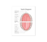 Implante de dientes arte corona Dental impresión dentista regalo anatomía los médico cuadro sobre lienzo for pared decoración clínica(DPH3567,42x60 cm No Frame)