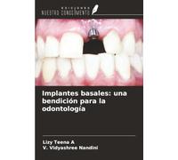 Implantes basales: una bendición para la odontología