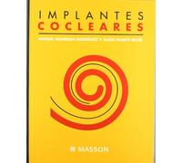 Implantes cocleares