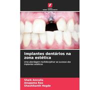 Implantes dentários na zona estética: Uma abordagem multidisciplinar ao sucesso dos implantes estéticos