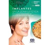 implantes en la zona estética. guía para el tratamiento del paciente p