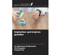Implantes quirúrgicos guiados