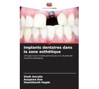 Implants dentaires dans la zone esthétique: Une approche multidisciplinaire pour la réussite des implants esthétiques