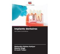 Implants dentaires: De la base à la brillance
