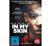 In My Skin (DVD) Beckinsale Kate Dagleish John Idris Damson (Importación USA)