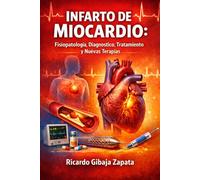 Infarto de Miocardio Fisiopatología, Diagnóstico, Tratamiento y Nuevas Terapias