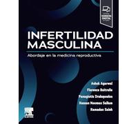 Infertilidad Masculina