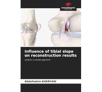 Influence of tibial slope on reconstruction results: anterior cruciate ligament