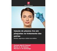 Injeção de plasma rico em plaquetas no tratamento das estrias: Eficácia, segurança e efeitos secundários