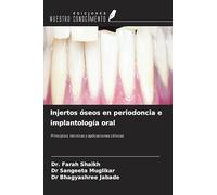 Injertos óseos en periodoncia e implantología oral: Principios, técnicas y aplicaciones clínicas