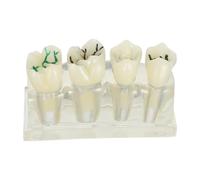 INOOMP Modelo de Dientes Caries Enseñanza Oral, Herramienta Tipodonto Dientes Removibles y Materiales Abs para Uso en Aula y Educación Dental