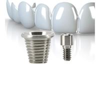 Insertos de localizador de implantes dentales, montaje de insertos de | Diálogo de implantes modelo dental para técnicos, dentistas, médicos, clínicas, laboratorios hospitalarios