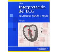 Interpretacion del ECG