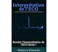 Interprétation de l’ECG: Rendre l’interprétation de l’ECG facile !
