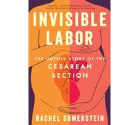 Invisible Labor: The Untold Story of the Cesarean Section