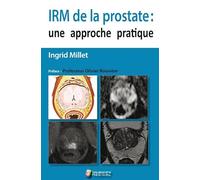 IRM de la prostate : une approche pratique