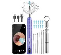 Jegoat Herramienta de eliminación de cera de oído, cámara con cámara HD 1296P y 6 luces LED, limpiador de oídos con 10 púas de oído, kit de eliminación de cera de oído mejorado para iOS y Android