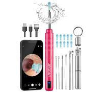 Jegoat Herramienta de eliminación de cera de oído, cámara con cámara HD 1296P y 6 luces LED, limpiador de oídos con 10 púas de oído, kit de eliminación de cera de oído mejorado para iOS y Android