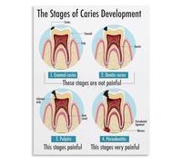 JMVLVLOA The Journey of Tooth Health An Illustrated Diagram Poster Canvas Wall-Art for Educational Center or Contemporary Lounge(Framed,16x24inch(40x60cm))