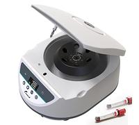 JOANLAB Máquina centrífuga de sobremesa para laboratorio Centrífugas Plasma PRP 2ml/5ml/10ml/15ml *6 Capacidad,500-5000rpm(Max. 3074xg),Pantalla digital con temporizador