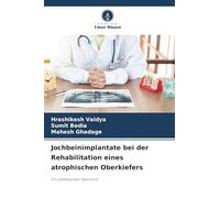 Jochbeinimplantate bei der Rehabilitation eines atrophischen Oberkiefers: Ein umfassender Überblick