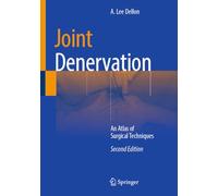 Joint Denervation: An Atlas of Surgical Techniques