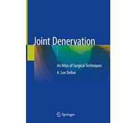 Joint Denervation: An Atlas of Surgical Techniques