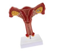 Josenidny 1:1 Humano Útero Ovario Trompas de Falopio Modelo Anatómico Anatomía Modelo Herramientas Pedagógicas
