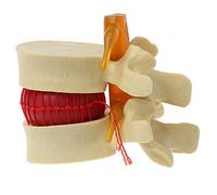 Josenidny Modelo de vértebras lumbares columna vertebral anatómica hernia disco lumbar herramienta de enseñanza anatomía modelo de vértebras lumbares