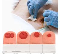 Juego de modelos de entrenamiento de estoma, kit de entrenamiento de cuidado de ostomía de 4 piezas, modelos de cuidado de heridas, modelo de ostomía fecal de simulación de mesa.