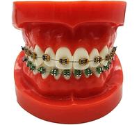 JUJNE Modelo de Soportes de Ortodoncia Dental, Modelo de Demostración de Ortodoncia Tipodonto Dental, Modelo de Dientes de Tratamiento con Soporte de Metal, Modelo de Explicación de Alambre de Arco