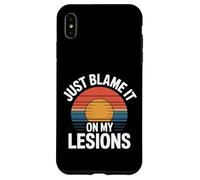 Just Blame It On My Lesions Esclerosis múltiple - Carcasa para iPhone XS MAX