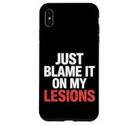 Just Blame It On My Lesions Esclerosis múltiple |- Carcasa para iPhone XS MAX