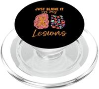 Just Blame It On My Lesions Esclerosis múltiple PopSockets PopGrip para MagSafe