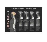 KCDFDVJFBM Chiropractic Office Decor Spine Anatomy Chart Educational Canvas Art Poster Wall Decor for Professionals Clinic Waiting Room(Unframed,08x12inch(20x30cm))